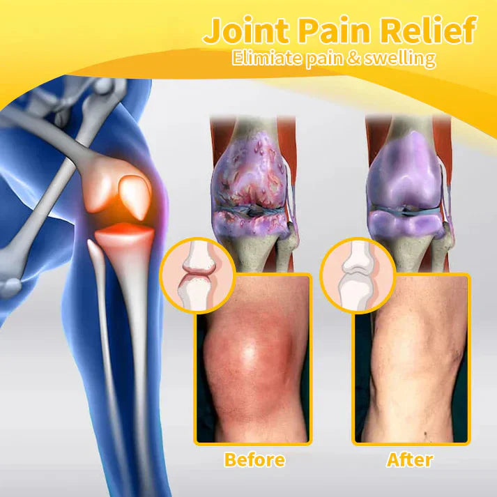 ✅Official Store: flysmus™ Bee-Venom Pain-Relief Bone Healing Cream👨⚕️Orthopaedic Association(AOA) Approved (Reducing joint swelling, pain, stiffness, redness, warmth, soreness, and joint fatigue)