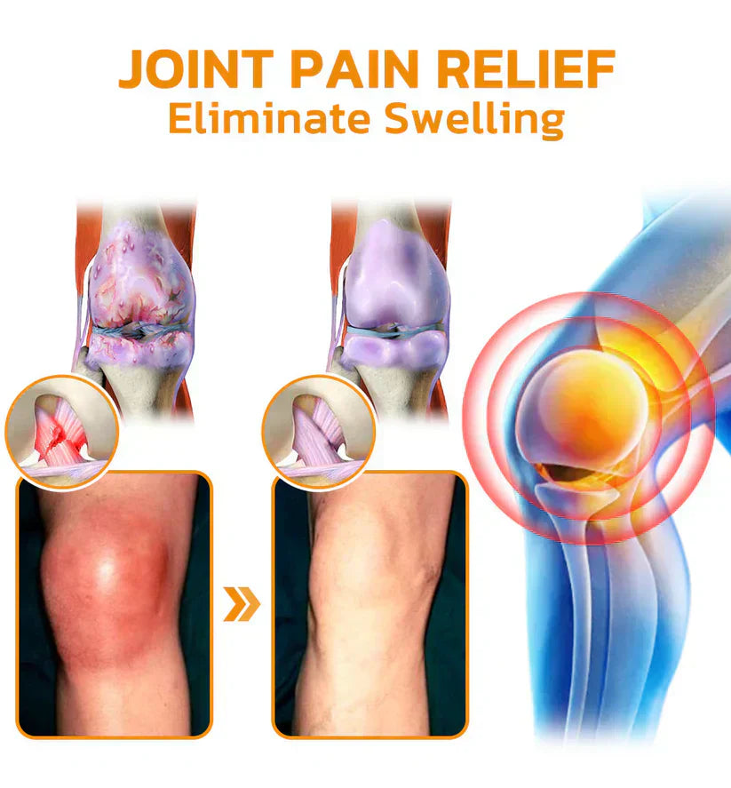 🎁⚡Ourlyard™ Magnesium Oil & Bee Venom Joint Healing Spray👨⚕️Approved by the Australian Orthopaedic Association (AOA)