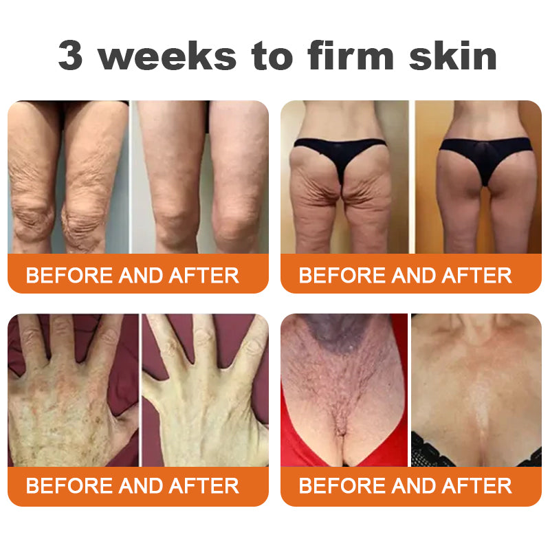 💧Flysmus™ Botox Bee Venom Firming Serum Stick-(Made and Shipped from Australia)-LAST DAY 70% OFF