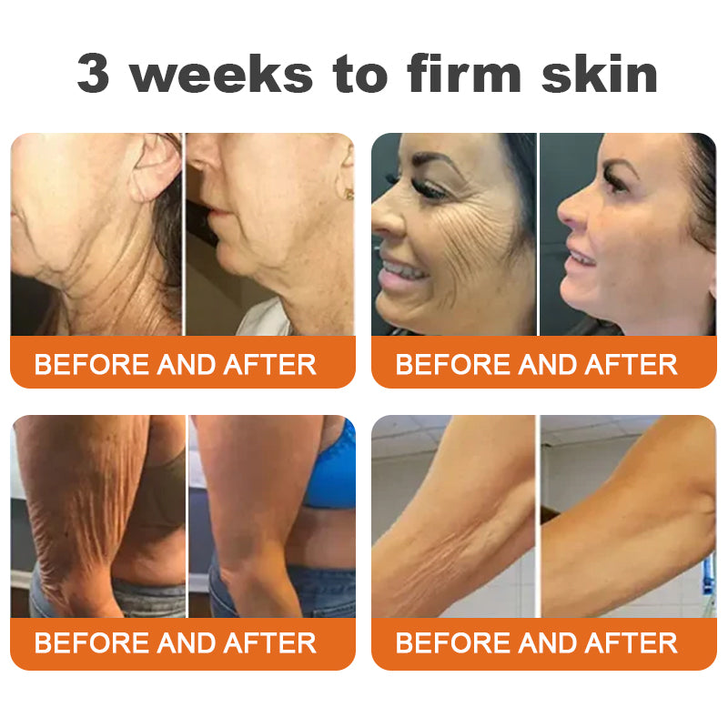 💧Flysmus™ Botox Bee Venom Firming Serum Stick-(Made and Shipped from Australia)-LAST DAY 70% OFF