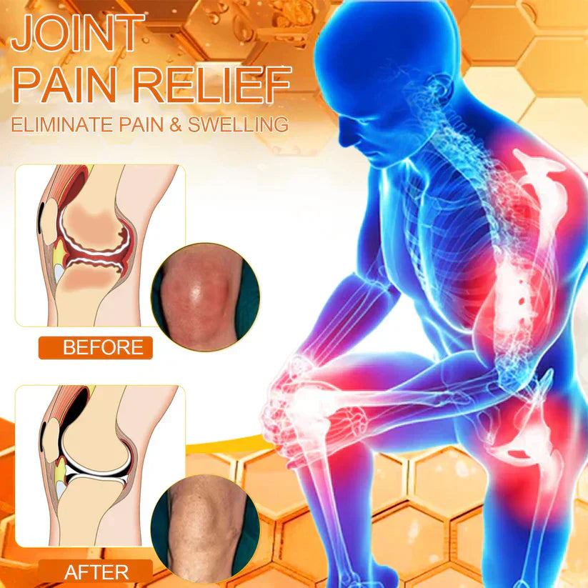 🎁⚡Ourlyard™ Magnesium Oil & Bee Venom Joint Healing Spray👨⚕️Approved by the Australian Orthopaedic Association (AOA)