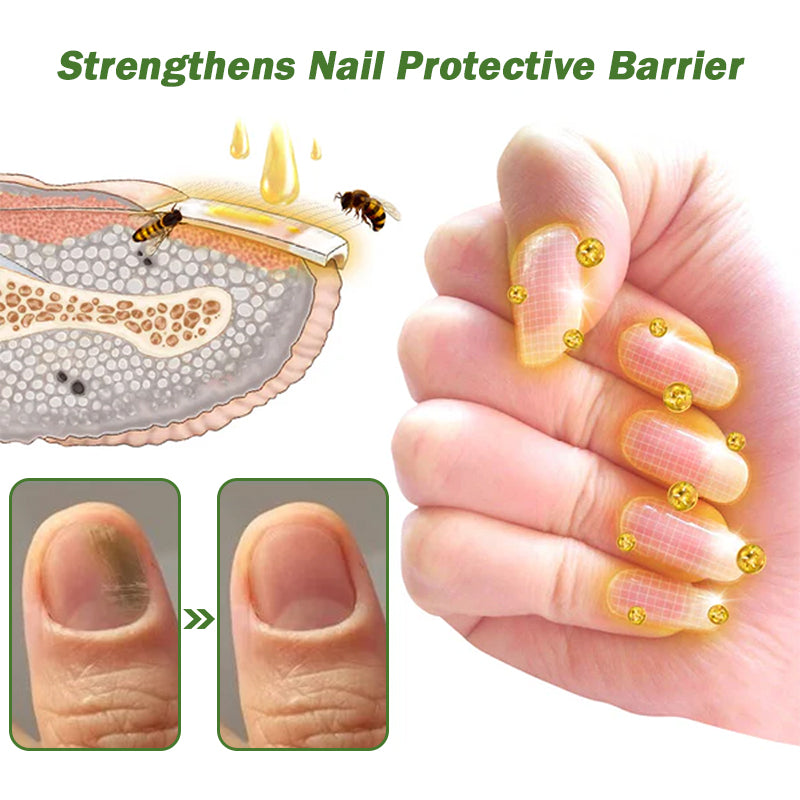 👩⚕️☘️Furzero™ Nail Defense Bee Venom Treatment Serum(For All Kinds Of Nail Diseases✅For Healthier Nail Growth)