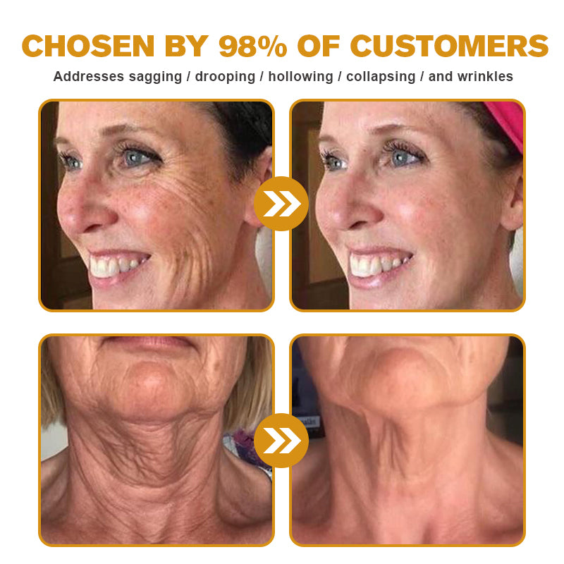 (š„³Made and Shipped from Australiaā
) Furzero⢠Botox Bee Venom Wrinkle Removal Cream- LAST DAY 70% OFF