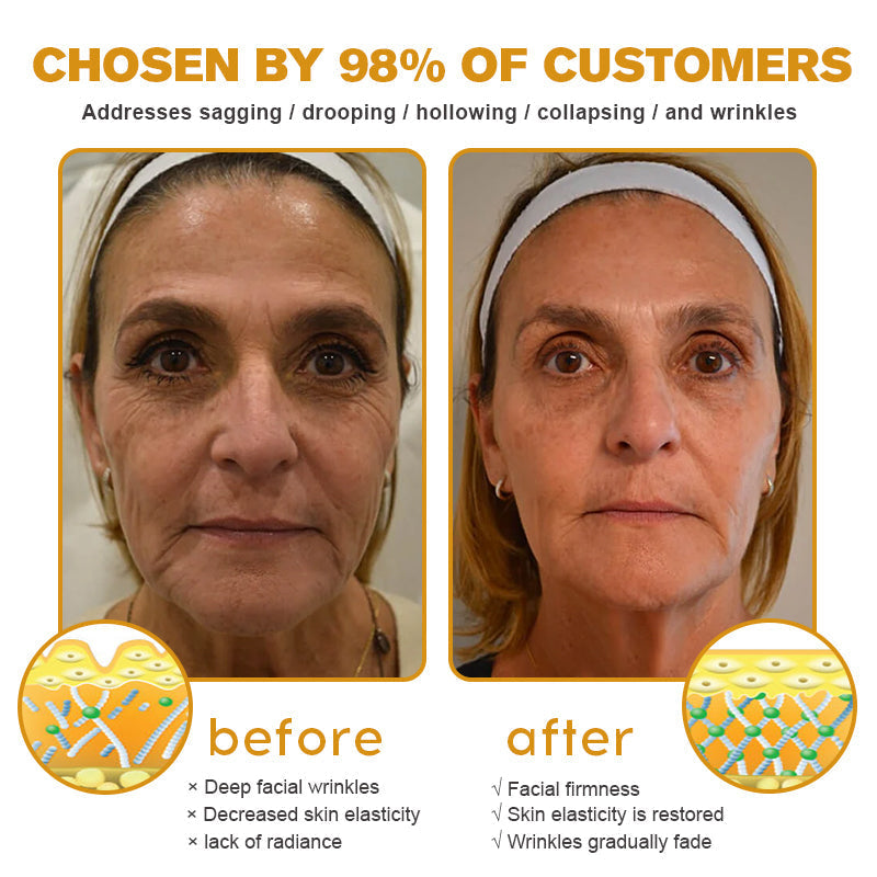(š„³Made and Shipped from Australiaā
) Furzero⢠Botox Bee Venom Wrinkle Removal Cream- LAST DAY 70% OFF