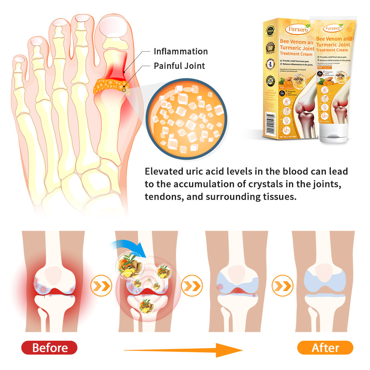 (✅Made and Shipped from Australia) Furzero™ Bee Venom and Turmeric Joint&Bone Treatment Cream