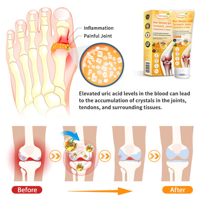 (✅Made and Shipped from Australia) Furzero™ Bee Venom and Turmeric Joint&Bone Treatment Cream