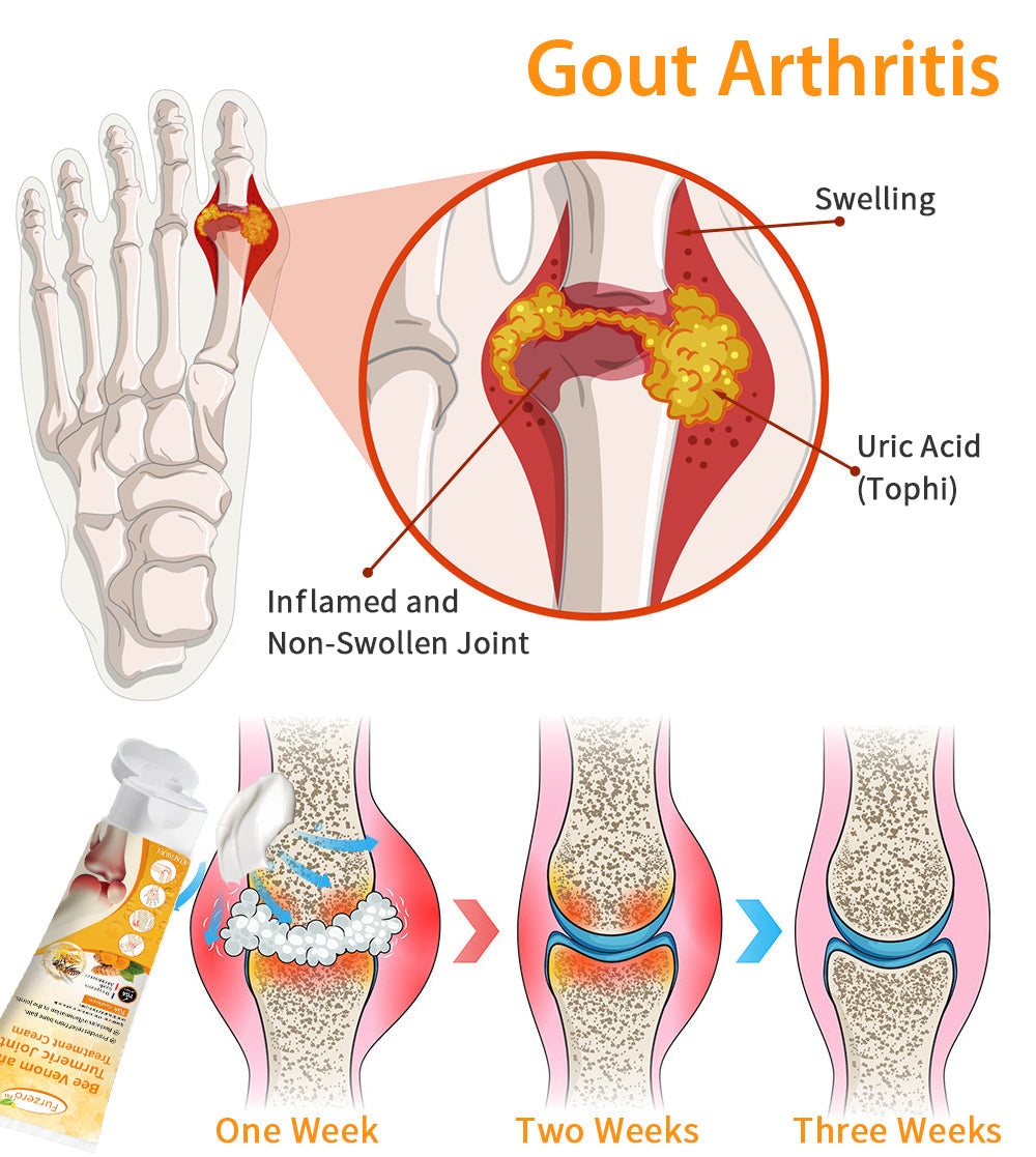 (✅Made and Shipped from Australia) Furzero™ Bee Venom and Turmeric Joint&Bone Treatment Cream