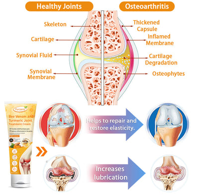 (✅Made and Shipped from Australia) Furzero™ Bee Venom and Turmeric Joint&Bone Treatment Cream
