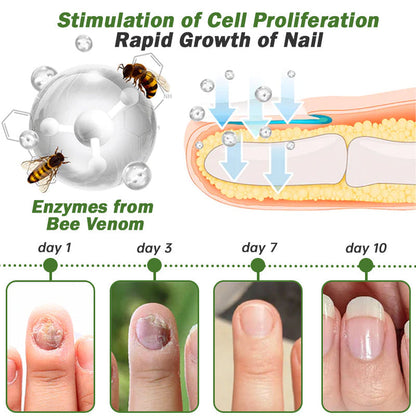 👩‍⚕️🌾Furzero™ Nail Defense Bee Venom Treatment Serum(For All Kinds Of Nail Diseases✅For Healthier Nail Growth)